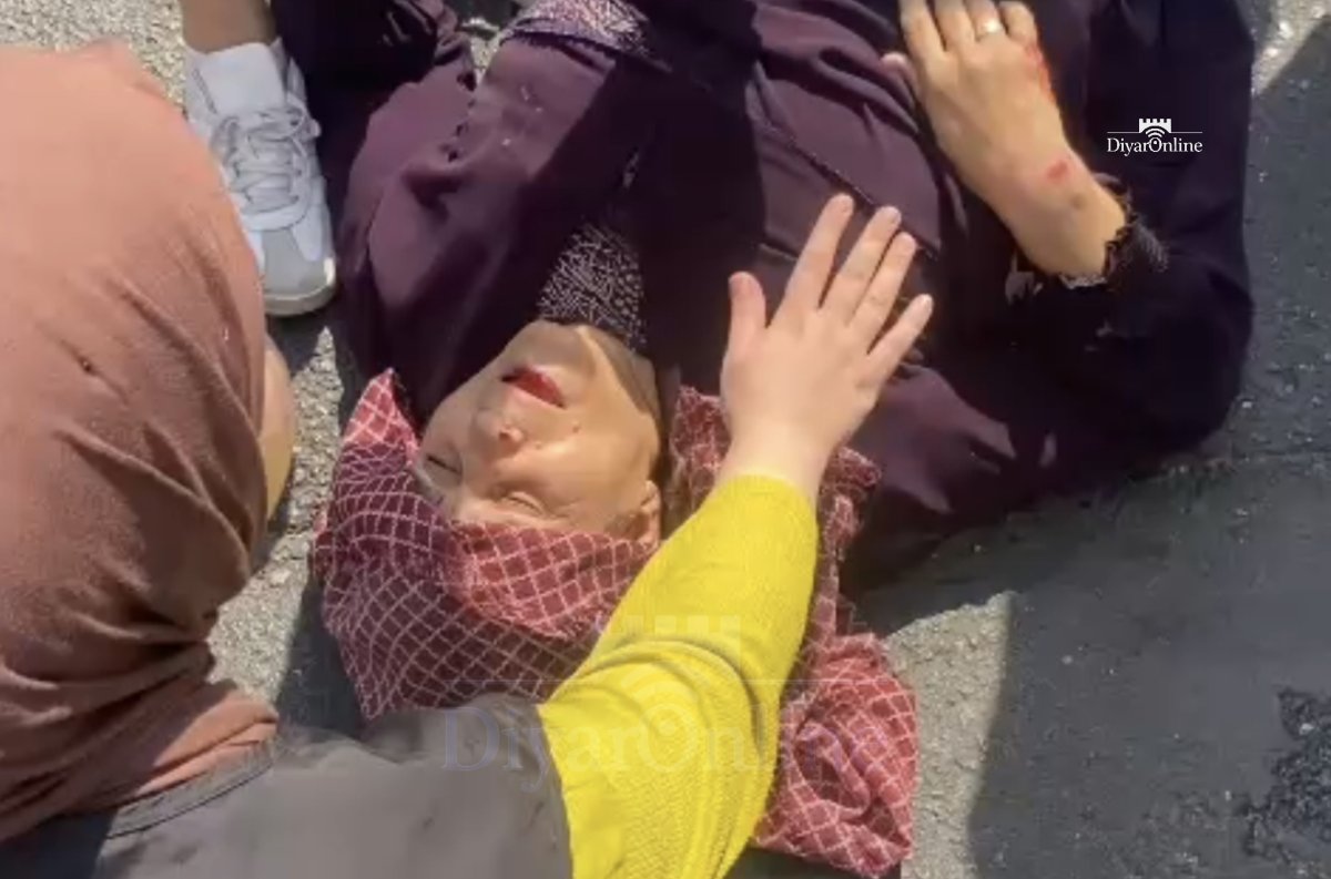 Diyarbakır’da Korkutan Kaza: Araç Yaşlı Kadına Çarptı